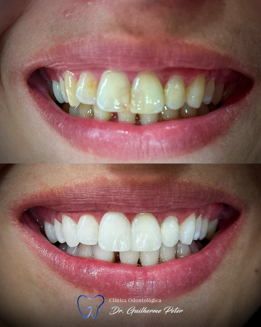 Resultado antes e depois 3