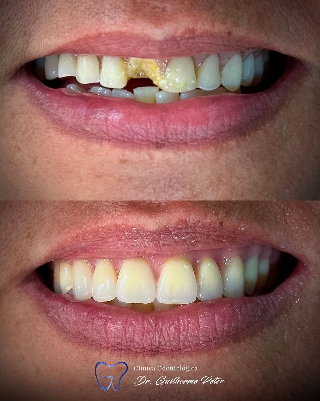 Resultado antes e depois 7